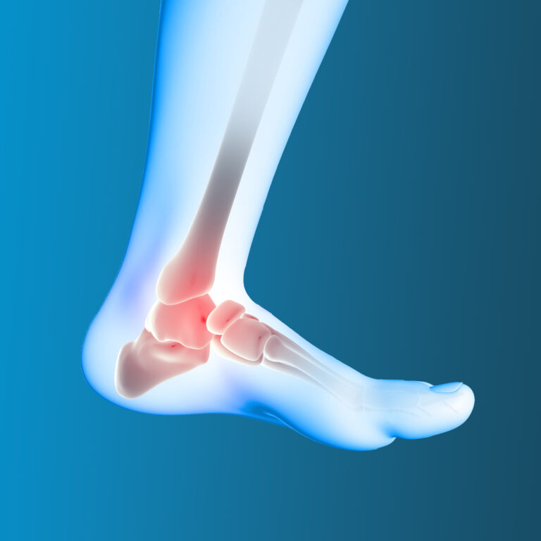 The Step Towards Stronger Bones: Exploring the Benefits of Walking