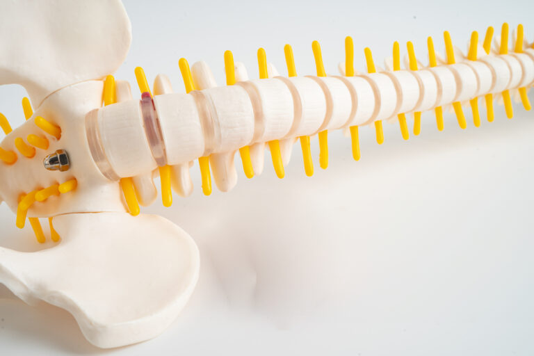 The Hidden Impact: How Prolonged Sitting in the Office Affects Bone Health and Posture