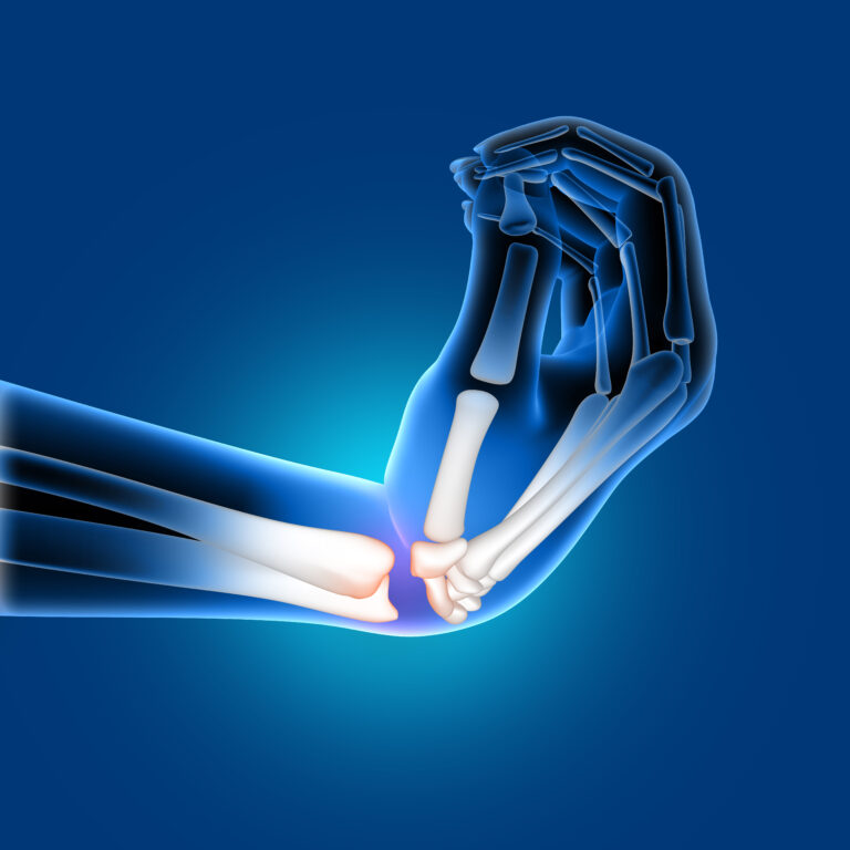 Juvenile Idiopathic Arthritis – Definition, Causes and risk factors, common signs, and long- term impact.
