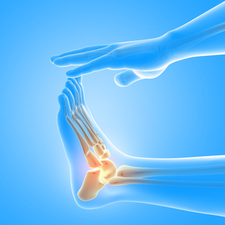 Dispelling Myths: The Truth About Orthopedic Surgery