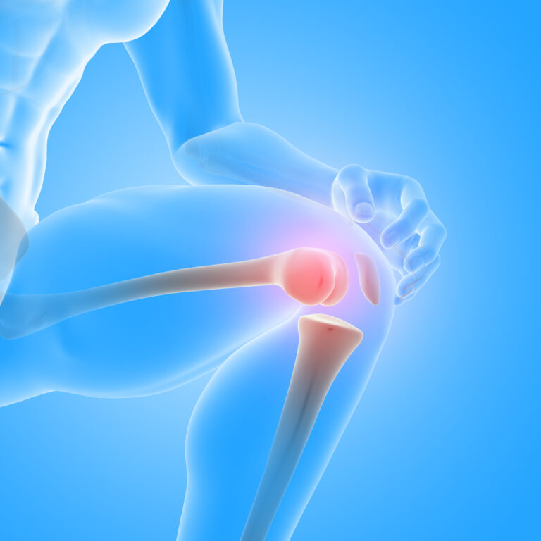 Confronting Phantom Limb Pain: Strategies for Healing