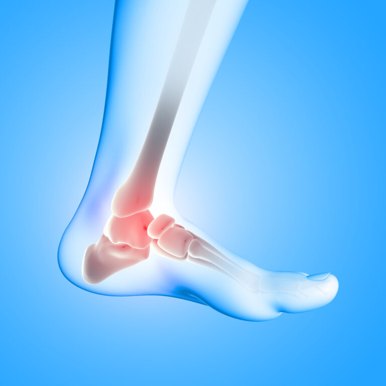 6 Common Foot Problems in Adults: Causes and Treatment
