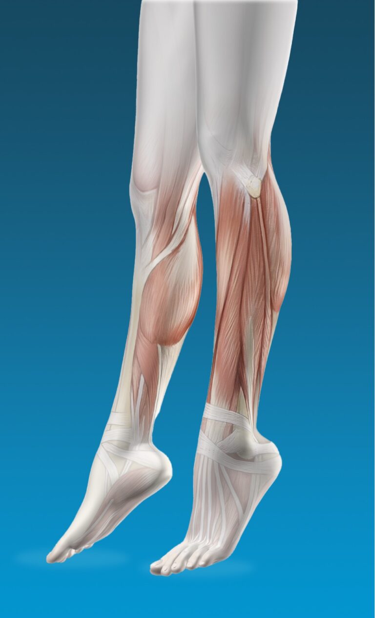 Charley Horse: Unraveling Symptoms, Causes, and Risk Factors