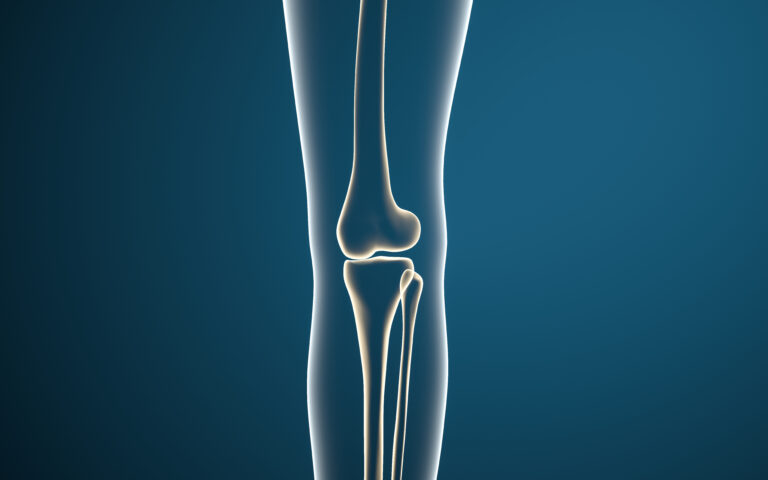 Bone Marrow Transplant: All You Need to Know