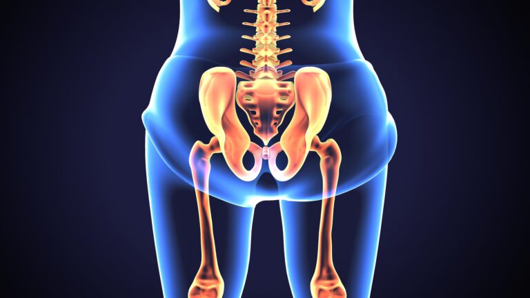 5 Misunderstood Facts About Hip Replacement Surgery