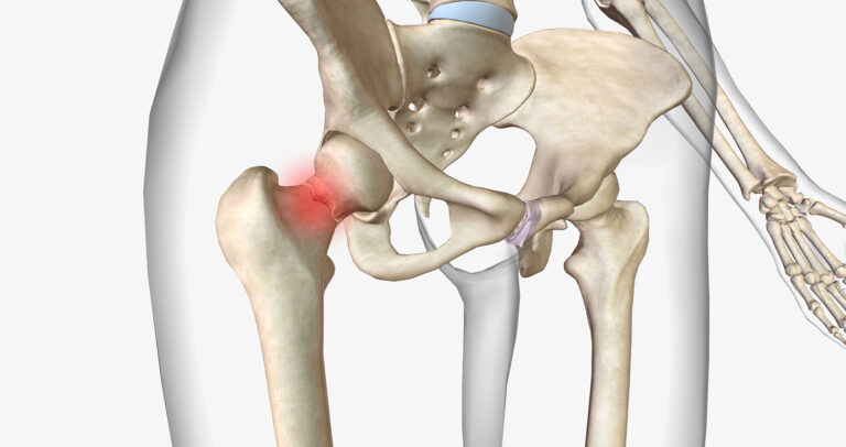 About the Hip: Anatomy, Function, and Common Issues