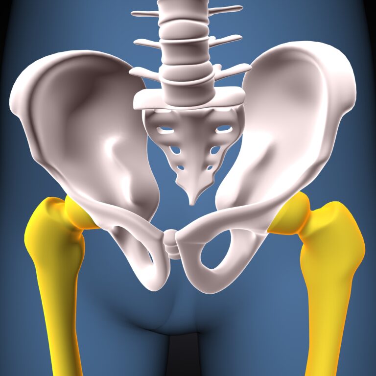 Optimal Resting Positions After Hip Replacement Surgery: Sitting Or Lying Down