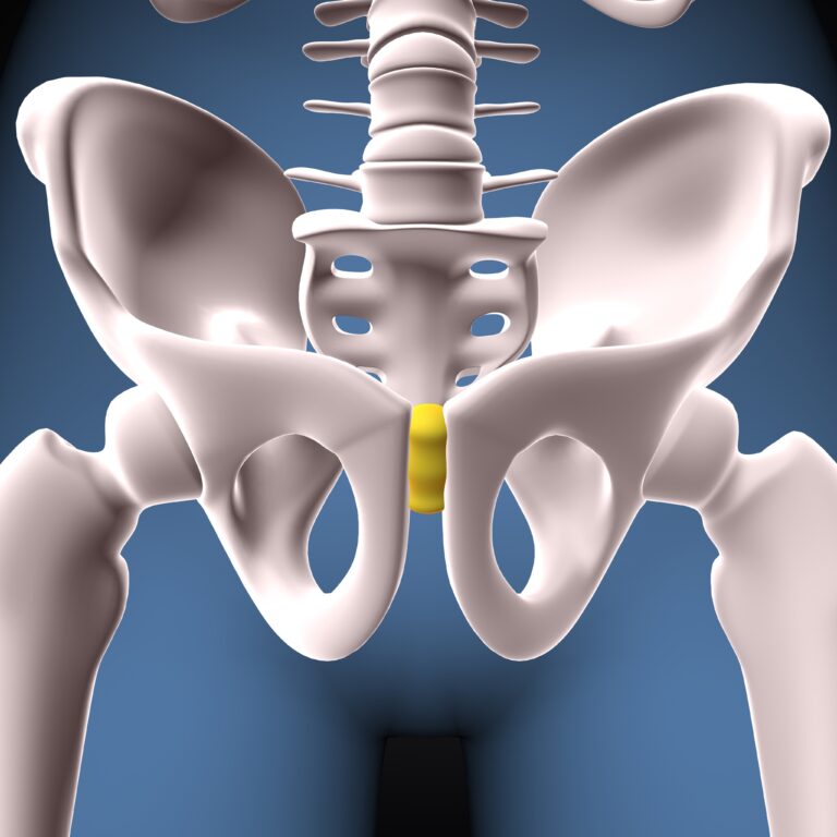 Common Causes of Hip Pain in Women