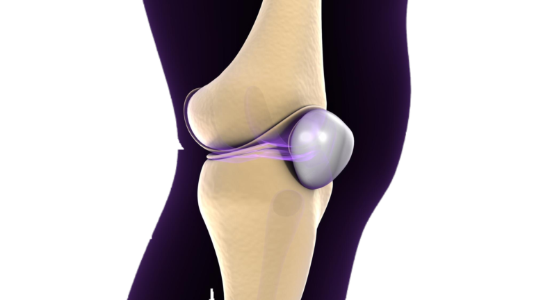Keep Moving: Safeguarding Your Knee Joints with Prevention