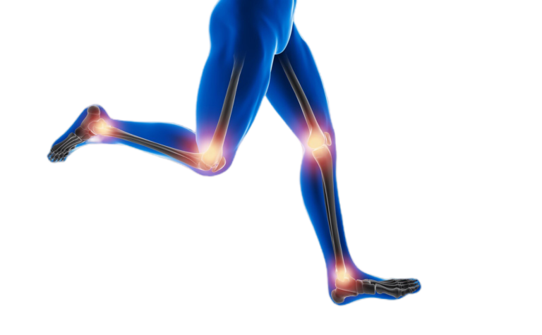 Osteoarthritis Management: Enhancing Joint Health