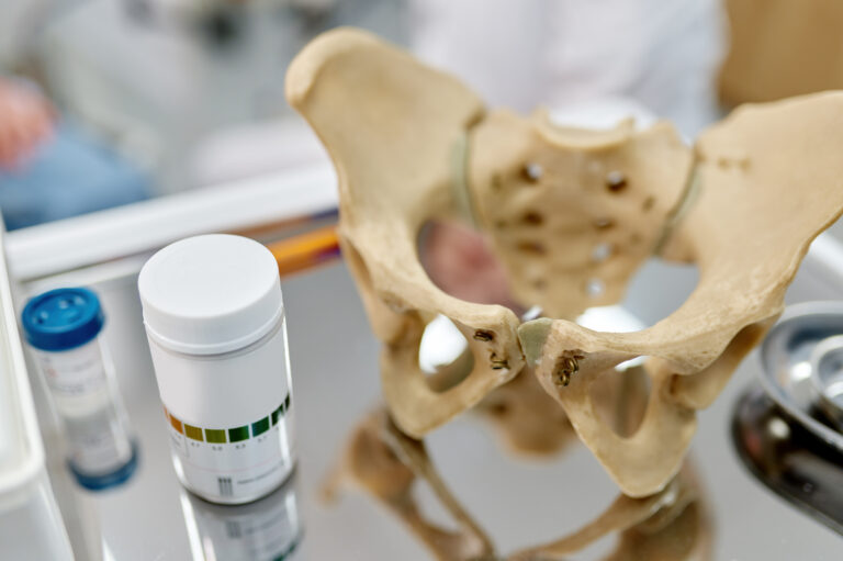 Understanding Hip Replacement: A Comprehensive Guide